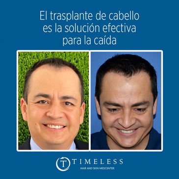 Slider image (6) Timeless Hair & Skin Medcenter